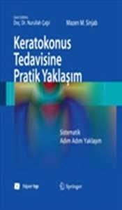 keratokonus-tedavisine-pratik-yaklasim